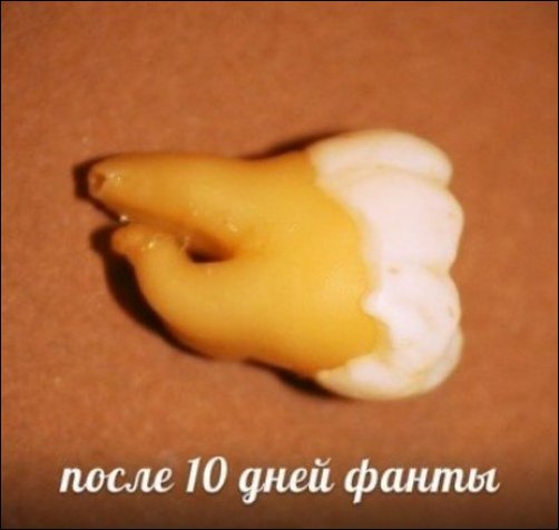 Зубы и популярные напитки Зубы и популярные напитки