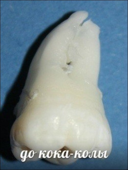 Зубы и популярные напитки Зубы и популярные напитки