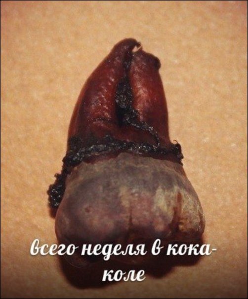 Зубы и популярные напитки Зубы и популярные напитки