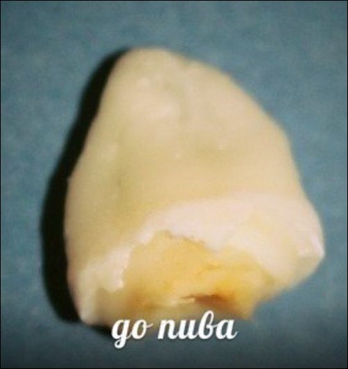 Зубы и популярные напитки Зубы и популярные напитки