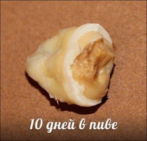 Зубы и популярные напитки Зубы и популярные напитки