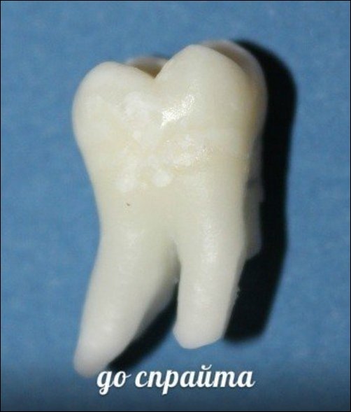 Зубы и популярные напитки Зубы и популярные напитки