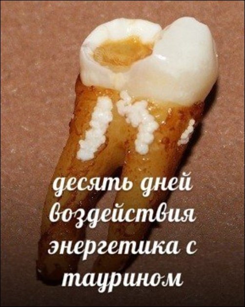 Зубы и популярные напитки Зубы и популярные напитки