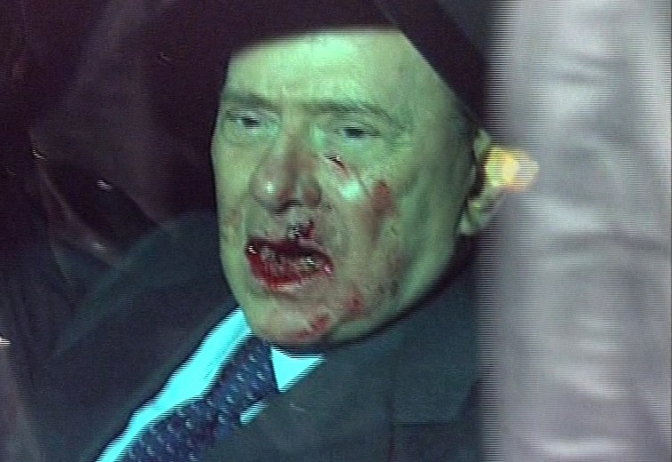 silvio-berlusconi-attacked-07