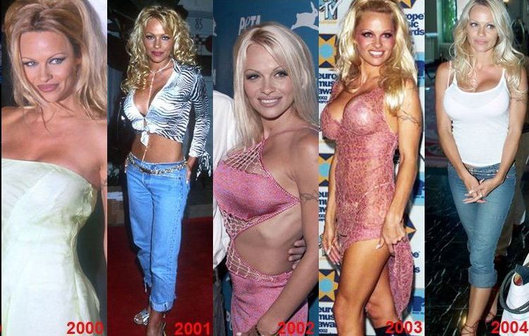 pamela-anderson-03