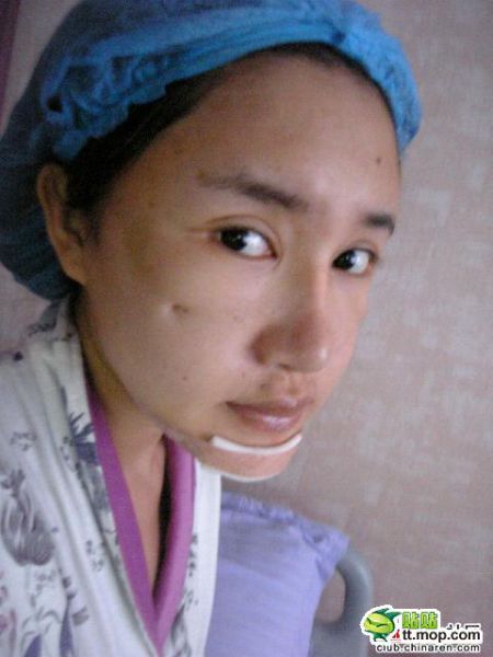 china-plastic-surgery-06