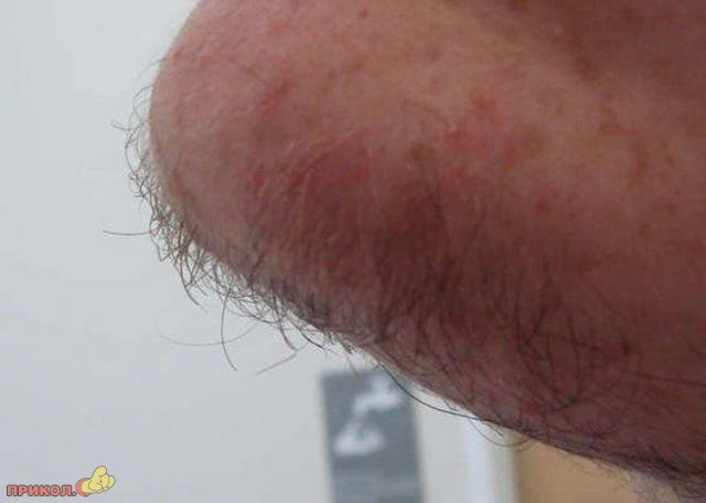 breetsya-zazhigalkoi-06